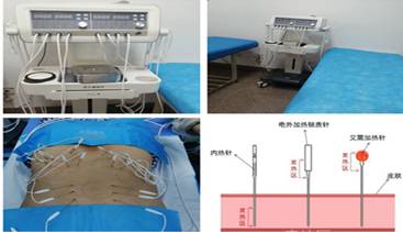 性干涉怎么治疗康复医学科(门诊)_https://www.jmylbn.com_新闻资讯_第9张